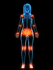 3d illustration of inflamed parts of body